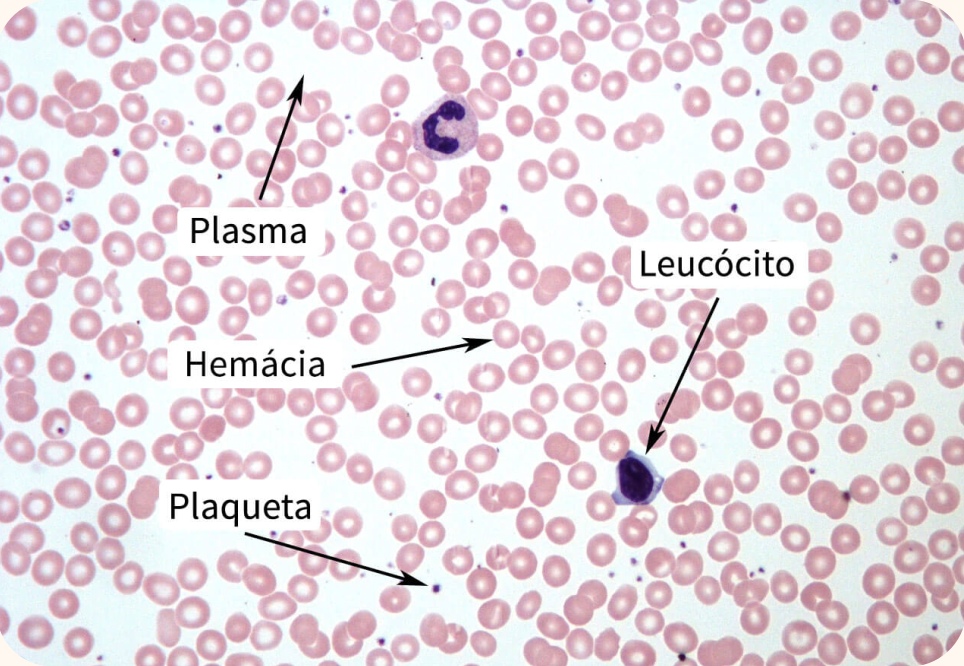 Observação Sangue